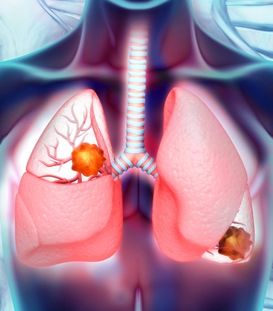 Building Better Lungs: How to Keep Them Healthy